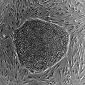 Any Adult Cell Can Become a Stem Cell