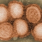 Atomic-Resolution Model of H1N1 Virus Created
