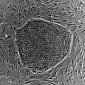 Autologous Stem Cell Bandage Enters Clinical Trials