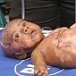 Baby Allegedly Catches Fire Out of the Blue, Doctors Suspect Spontaneous Human Combustion