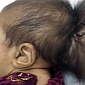 Baby with Two Heads Gets Surgery in Afghanistan