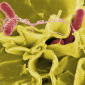 Bacterial Filters Reduce Hospital Infections