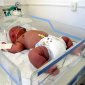 Birth Weight, Linked to Adult Health and Income