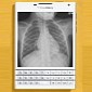 BlackBerry Passport Display Clarity Demoed with X-Ray, Medical Apps