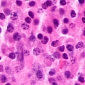 Blood Cancer More Genetically-Diverse than Thought