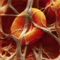 Blood Clots Linked to Dementia