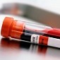 Blood Test Diagnoses Depression, Predicts Response to Therapy