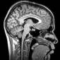 Brain Area Controlling Desire to Move Identified
