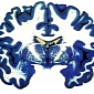 Brain Growth Hampered by Childhood Neglect