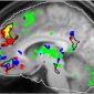 Brain Hub Links Memory, Music and Emotions