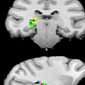 Brain Region Responsible for Focus on Important Stimuli Found