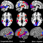 Brain Regions Can Switch Function