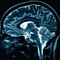Brain Scans Now Said to Predict Which Criminals Are Bound to Reoffend