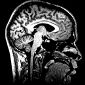 Brain Stimulations Can Influence Morality
