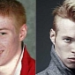 British Man Bullied for Ginger Hair Becomes Vogue Model