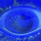 Canvas Imprint on Teen Girl's Cornea Caused by Airbag