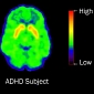 Checking Whether ADHD Drugs Boost Dopamine Levels