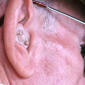 Curing Deafness One Step Closer