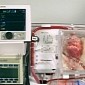 Dead Hearts Resuscitated and Transplanted into Patients in Medical First