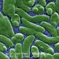 Decision in Flesh-Eating Bacteria Case Upheld