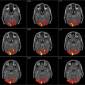 Depression Risk Assessed by Analyzing Brain Activity