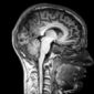 Diagnosing Brain Disorders in Athletes Through a Virtual Biopsy