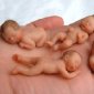Dioxin Contamination Disrupts Birth Sex Ratio: More Girls than Boys!