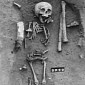 Down Syndrome Telltale Signs Documented in 1,500-Year-Old Skeleton