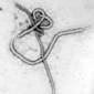 Ebola Virus Infections Stopped in the Lab