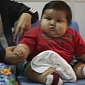 Eight-Month-Old Colombian Baby Boy Weighs 19.7Kg (44Lb), Placed on Strict Diet