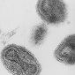 Elimination of Smallpox Vaccine Allowed Related Virus to Thrive