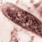 Extra-resistent Tuberculosis in the U.S.
