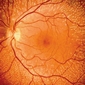 Eye Cells, An Efficient Cure for Parkinson's