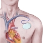 FDA: iPods Don't Interfere with Pacemakers