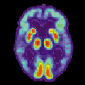 FMRI Can Detect Early Onset of Alzheimer’s