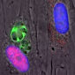Finding the Most Dangerous Toxoplasma Parasite