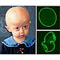 First Human Model Gives Insight on Hutchinson-Gilford Progeria Syndrome