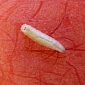 Flesh-Eating Maggots Nestle Inside 27-Year-Old Woman's Ear