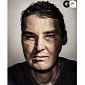 Full Face Transplant Recipient Makes It on the Cover of Men's Magazine GQ