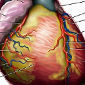 Gene Boosting Heart Disease Risk Found