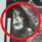 Ghost of Dead Mother-in-Law Appears in Pregnant Woman's Ultrasound