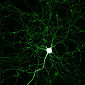 Guiding the Growth of Axons