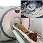 Heart Diseases Found in Ancient Mummies