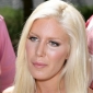 Heidi Montag Addicted to Painkillers, Fame