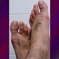 Hobbit Feet: Men Removing Hair from Their Feet Is Now a Trend