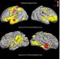 How Does Our Brain Develop Its Folds?
