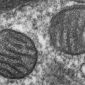 How Your Mitochondria Can Kill You