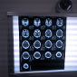 How fMRI Is Used in Courts of Law