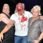 Hulk Hogan Left Bloodied During Australia Press Conference