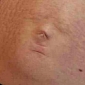 Human Face Appears on Soon-To-Be Mother's Baby Bump